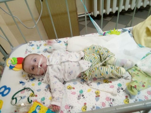 Не дихає, коли спить: у семимісячного волинянина з багатодітної сім’ї – рідкісна недуга