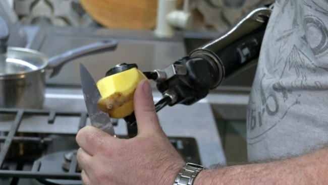 Відсічена рука й осколок, що застряг у щелепі: історія волинського воїна Михайла Бартошика