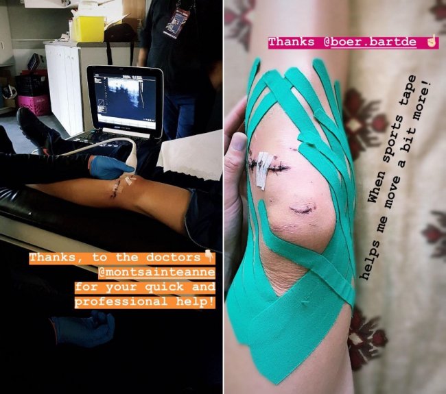 Велочемпіонка з Луцька отримала страшну травму та пропустить чемпіонат світу. ФОТО