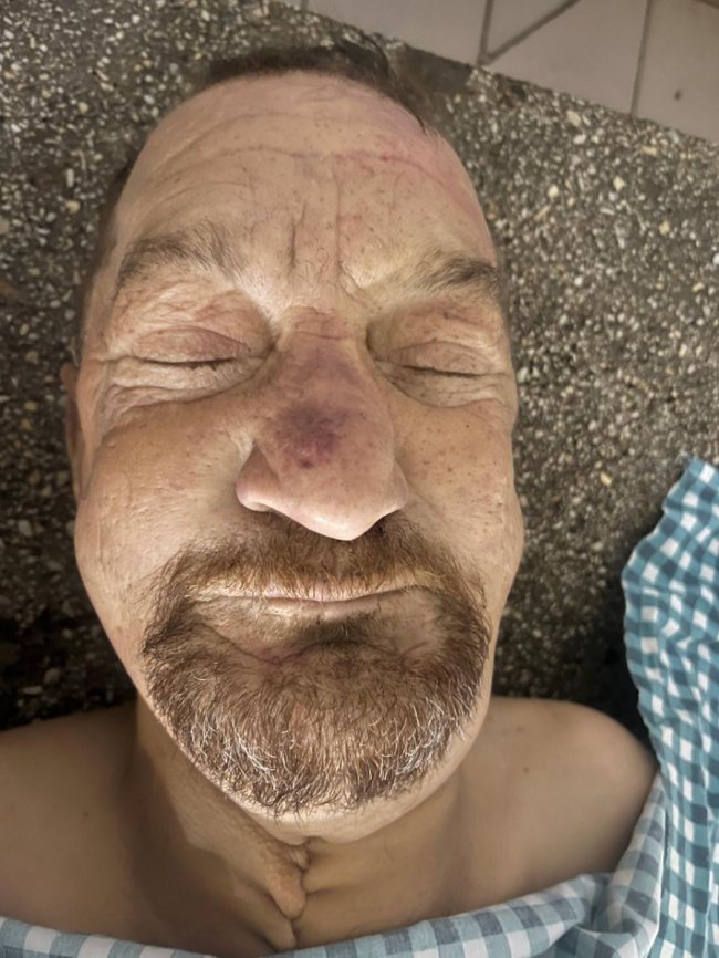 На сміттєзвалищі біля Луцька знайшли тіло чоловіка, просять опізнати. ФОТО 18+