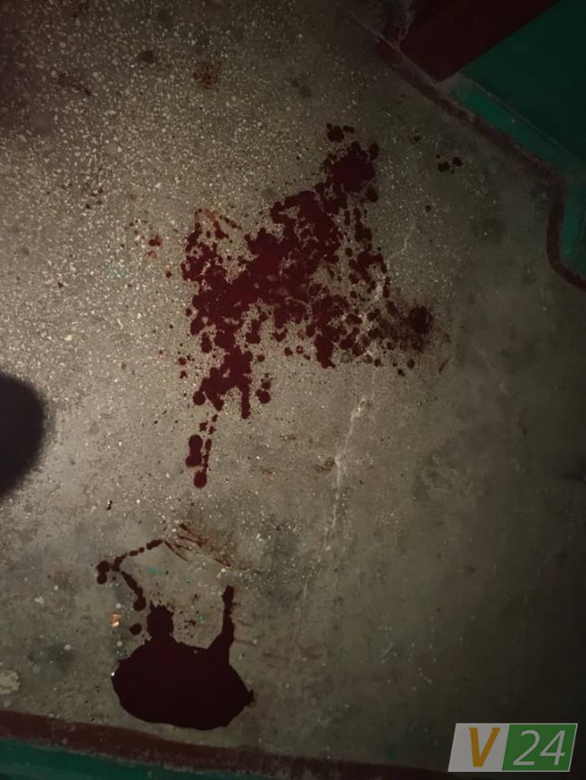 Хотів погуляти: лучанин зламав носа своїй дружині. ФОТО