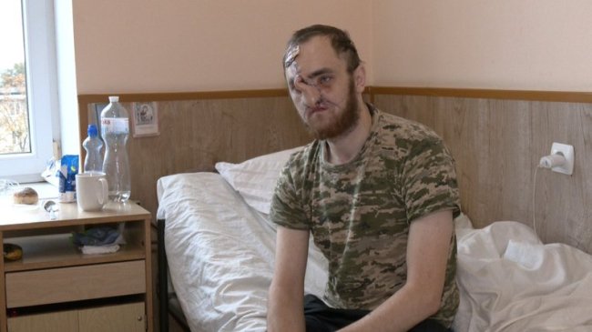 Волинські лікарі з канадськими колегами відновлюють обличчя пораненому воїну. ВІДЕО