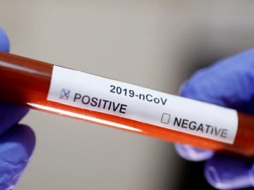 Де на Волині виявили нові випадки коронавірусу станом на ранок 7 червня 