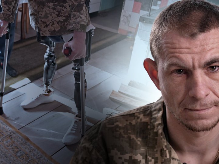 Дивом вижив під обстрілами: історія волинянина, який має подвійну ампутацію ніг