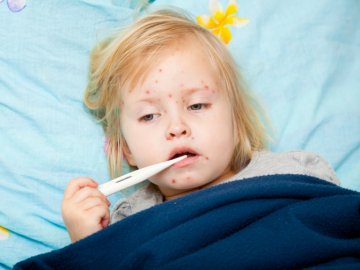 За тиждень в Україні – майже 500 хворих на кір