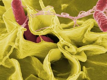 Медики завершили розслідування отруєння у «Садибі на джерелах»