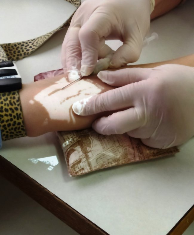 Ін’єкції майже безболісно: у дитячій поліклініці Луцька з’явився венозний сканер 