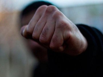 У Луцьку чоловік побив свого знайомого: потерпілий - у реанімації