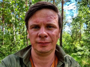 Комарі покусали Комарова: у ведучого після Волині розпухло обличчя