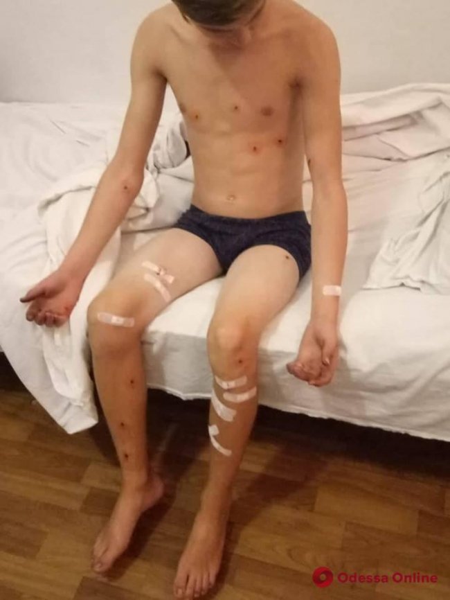 Чоловік посеред вулиці вистрілив у дітей з рушниці. ФОТО