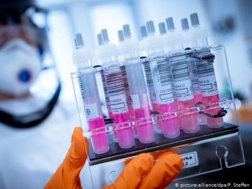 На Волині від COVID-19 за добу – 5 смертей: ситуація з коронавірусом в області станом на 25 жовтня