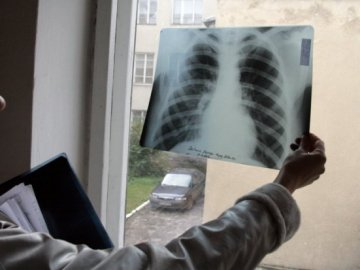 У виховательки в садочку виявили відкриту форму туберкульозу