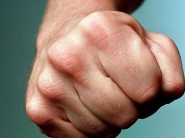 На Волині під час застілля 24-річний хлопець жорстоко побив товариша