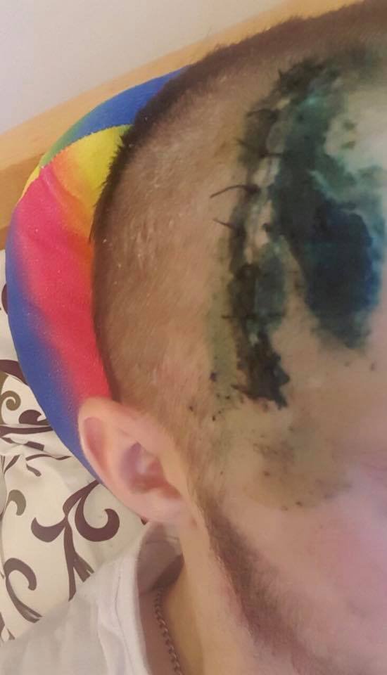 Боєць з Волині, який постраждав в аварії, потребує негайної допомоги