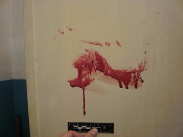 На Волині чоловік напав на товариша з ножем. ФОТО