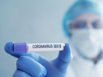 Новий антирекорд: в Україні – 2 836 нових випадків коронавірусу за добу, на Волині – 68