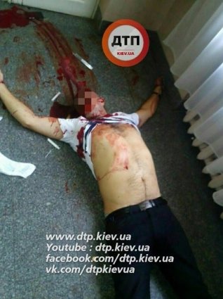 У Києві в лікарні застрелили людину. ФОТО