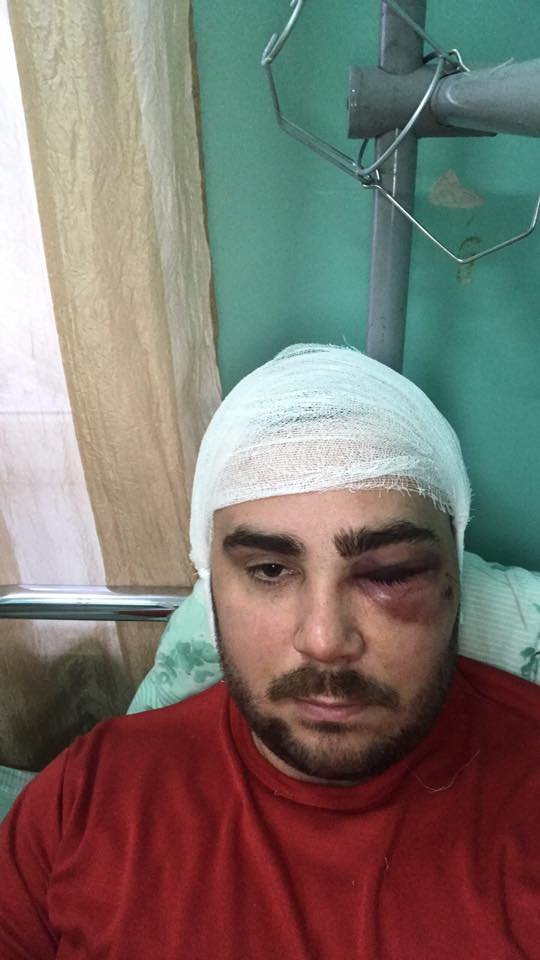 Двоє нетверезих чоловіків побили активіста «АвтоЄвроСили». ФОТО