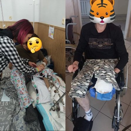 Лучанки зі «Швейної роти» виготовляють спеціальний одяг для поранених воїнів. ФОТО, ВІДЕО