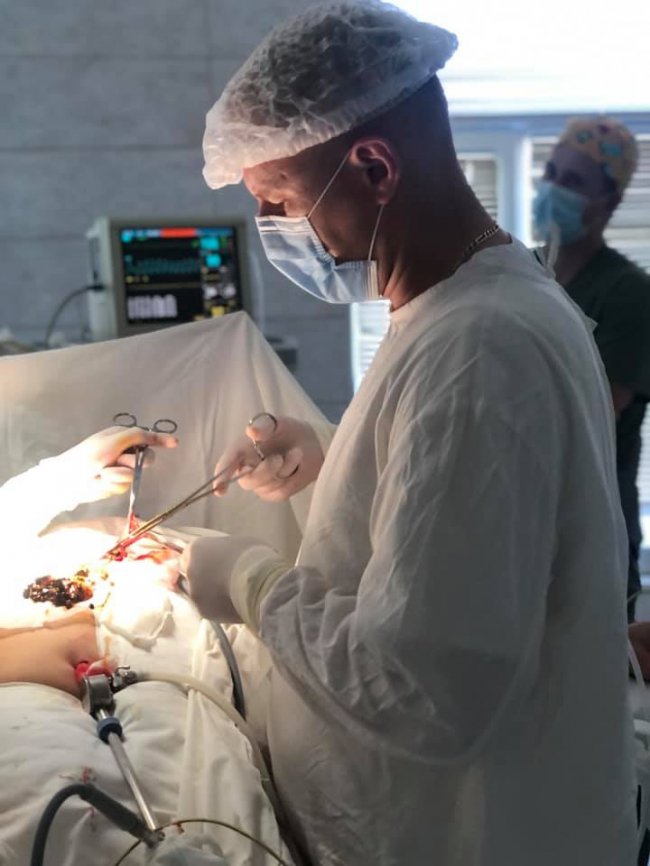 Із жовчного волинянки медики видалили 242 камінця без розрізів. ФОТО