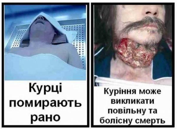 Якими малюнками на пачках цигарок лякатимуть курців. ФОТО