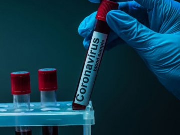 Повідомили, скільки інфікованих коронавірусом виявили в Україні за минулу добу