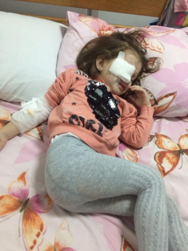 Під час бійки в дитсадку дівчинку вдарили олівцем в око. ФОТО