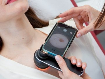 У селі неподалік Луцька охочим безкоштовно перевірятимуть родимки 