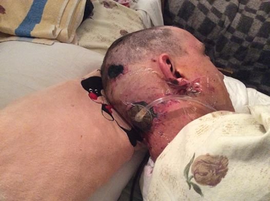 Військовий з Волині дивом вижив після вибуху на бойовій машині. ФОТО