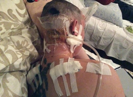 Військовий з Волині дивом вижив після вибуху на бойовій машині. ФОТО