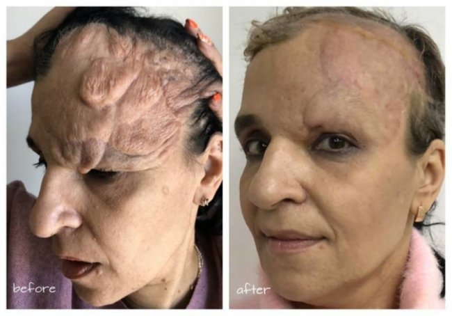 Відомий хірург з Волині врятував жінці обличчя після складної хвороби. ФОТО