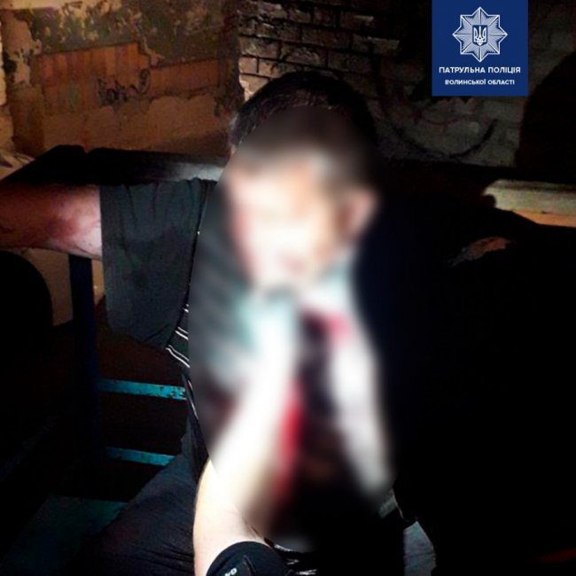 У Луцьку чоловіка поранили ножем у шию. ФОТО