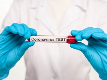 Лабораторний центр у Луцьку почав робити платні ПЛР-тести для всіх охочих