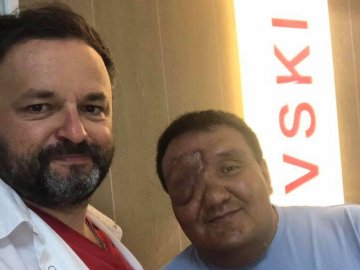 Відомий хірург з Волині прооперував чоловіка з пухлиною на обличчі. ФОТО