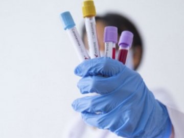 У волинській психлікарні коронавірусну інфекцію  виявили у 14 людей