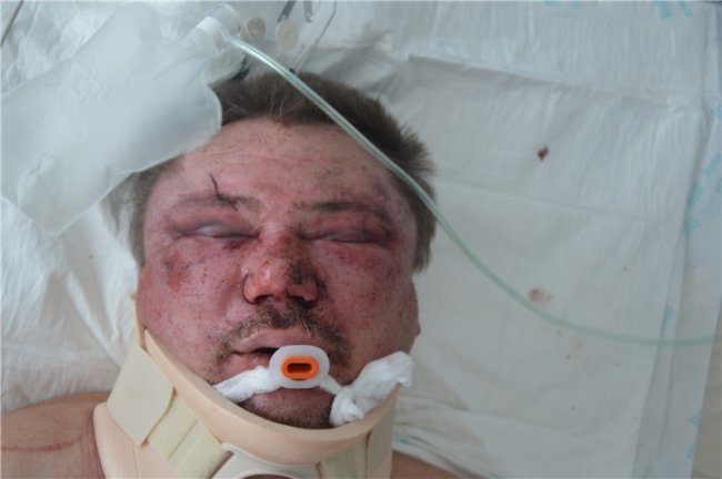 На Волині знайшли чоловіка у важкому стані, шукають родичів. ФОТО