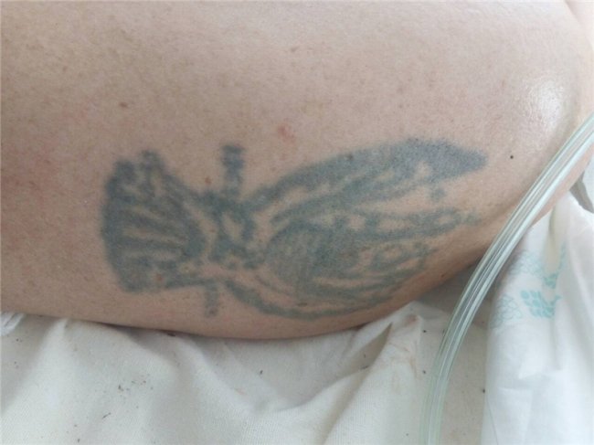 На Волині знайшли чоловіка у важкому стані, шукають родичів. ФОТО