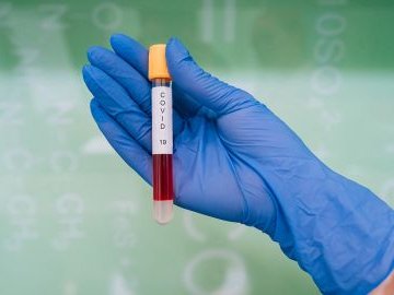 Повідомили статистику щодо коронавірусу в Україні за минулу добу