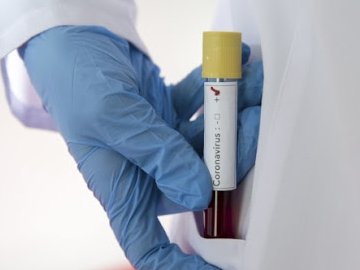 Нові випадки коронавірусу на Волині: серед захворілих – медсестра та пацієнт