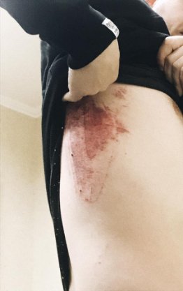 «Це було легендарно»: під співаком у Луцьку провалилася сцена