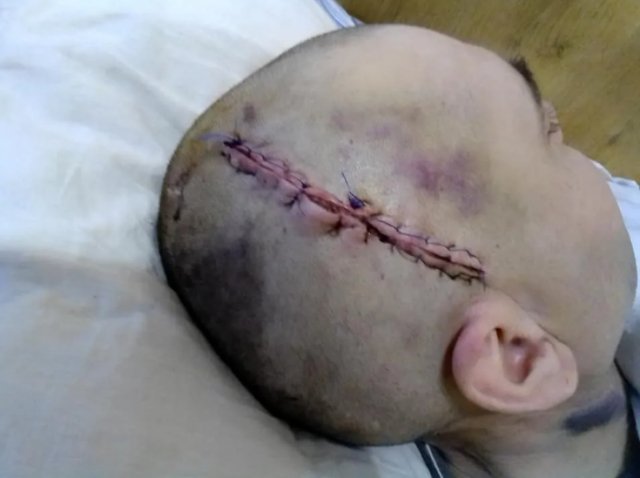 Бив берцями по голові і залишив стікати кров'ю: на Волині офіцер познущався над підлеглим. ФОТО