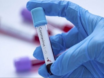 Волинський лікар розповів, що коронавірус негативно впливає на нервову систему. ВІДЕО