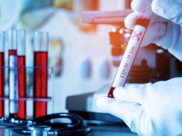 Де на Волині виявили нові випадки коронавірусу 