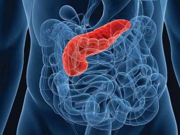 Як розпізнати рак підшлункової залози 