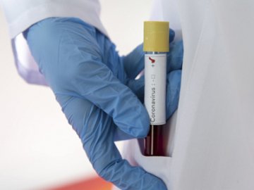 У районі на Волині від коронавірусу померла людина