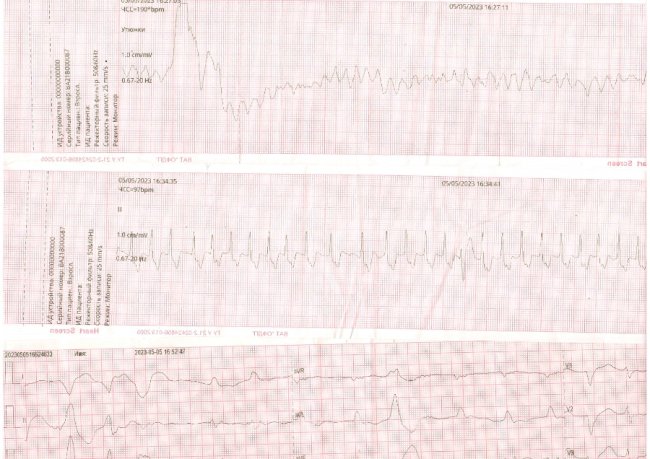 На Волині медики повернули до життя чоловіка після зупинки серця