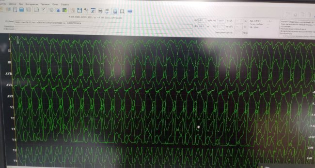 Медики «швидкої» відновили серцевий ритм 50-річному волинянину 