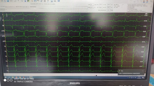 Медики «швидкої» відновили серцевий ритм 50-річному волинянину 
