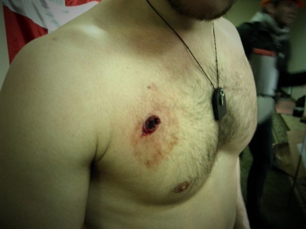 Фото поранених бійців Волинської сотні