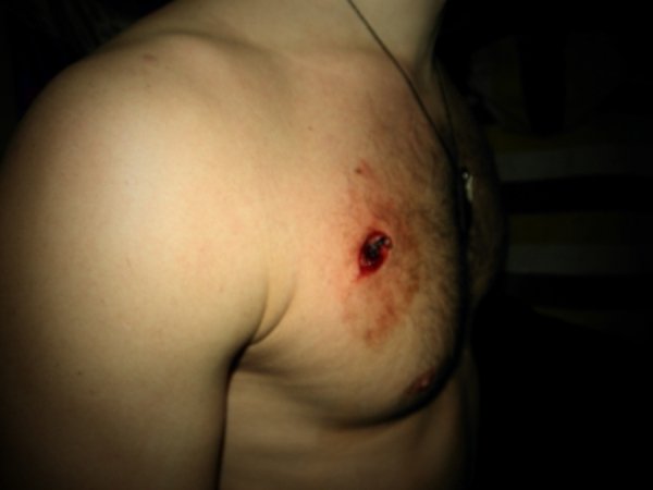 Фото поранених бійців Волинської сотні